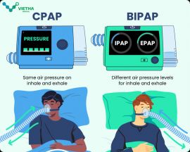 SỰ KHÁC NHAU GIỮA MÁY TRỢ THỞ CPAP VÀ BIPAP